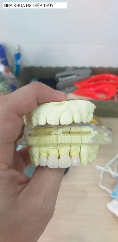 Hình ảnh NHA KHOA BS DIỆP THÚY
