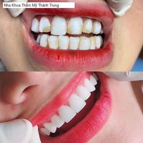 Hình ảnh Nha Khoa Thẩm Mỹ Thành Trung